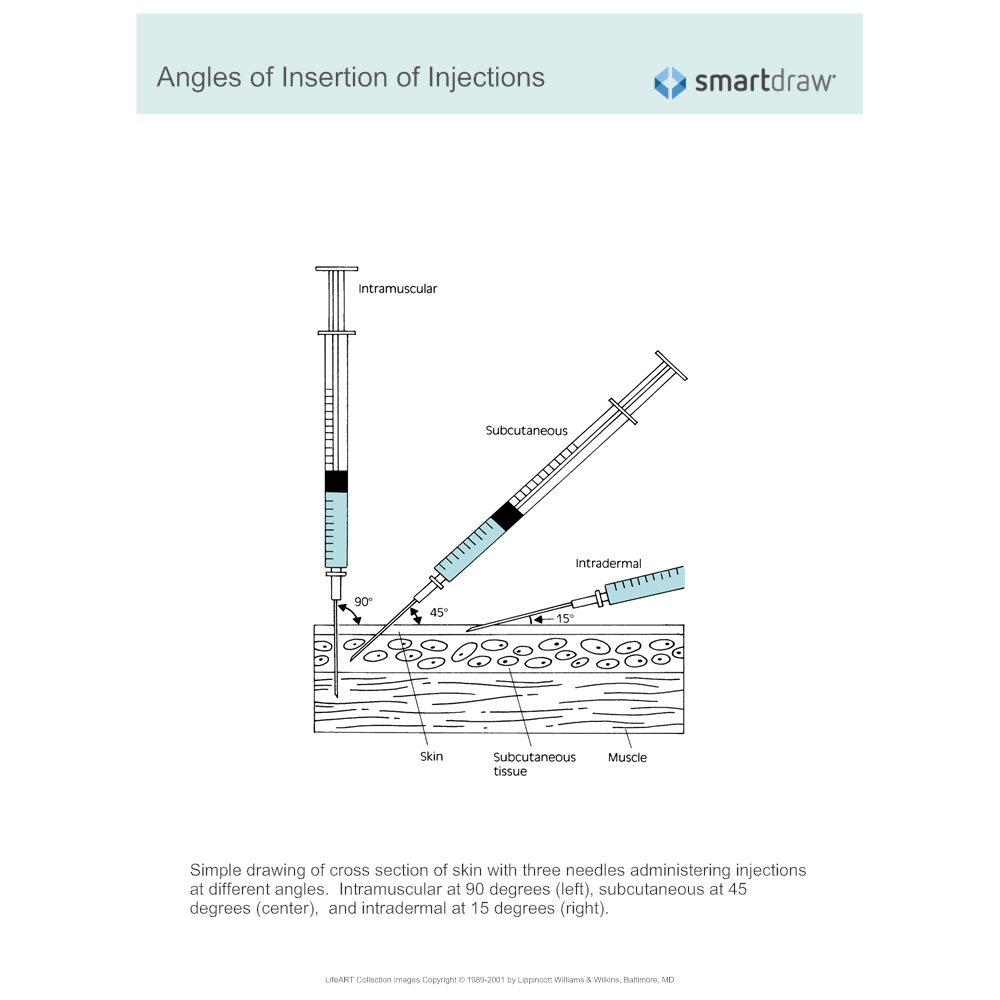 Example Image: Angles of Insertion of Injections