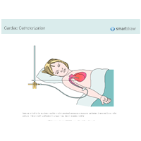 Cardiac Catheterization of a Child