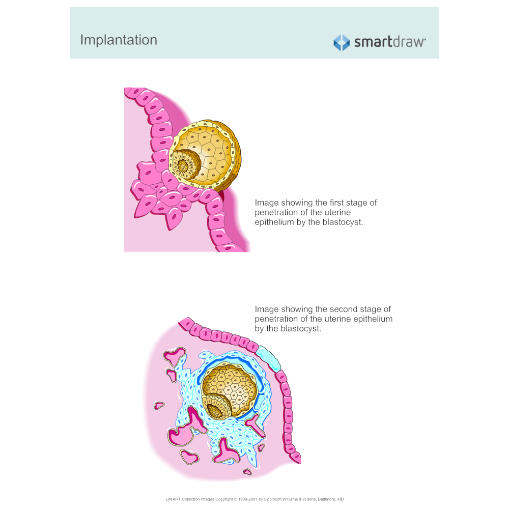 Example Image: Implantation