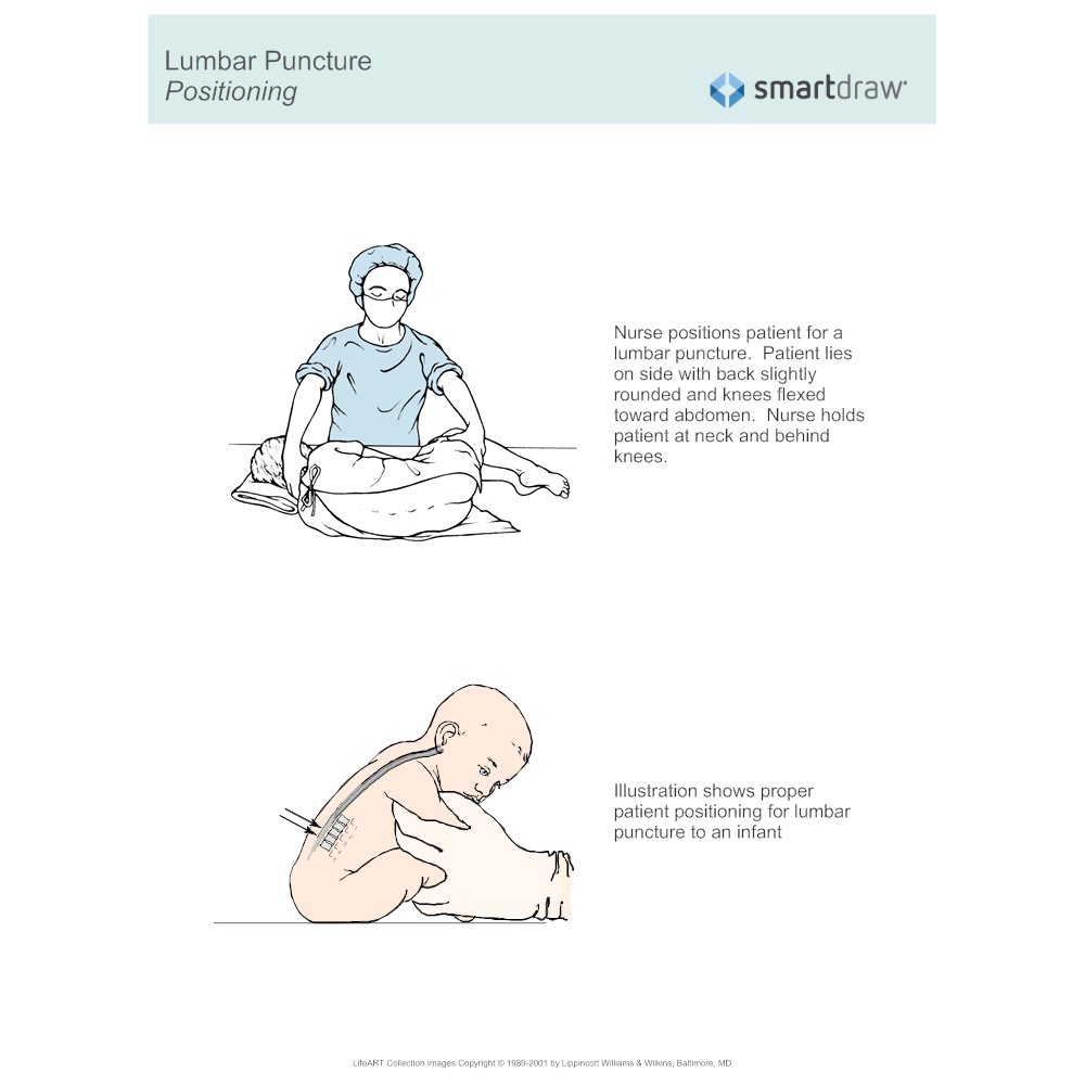 Example Image: Lumbar Puncture - Positioning