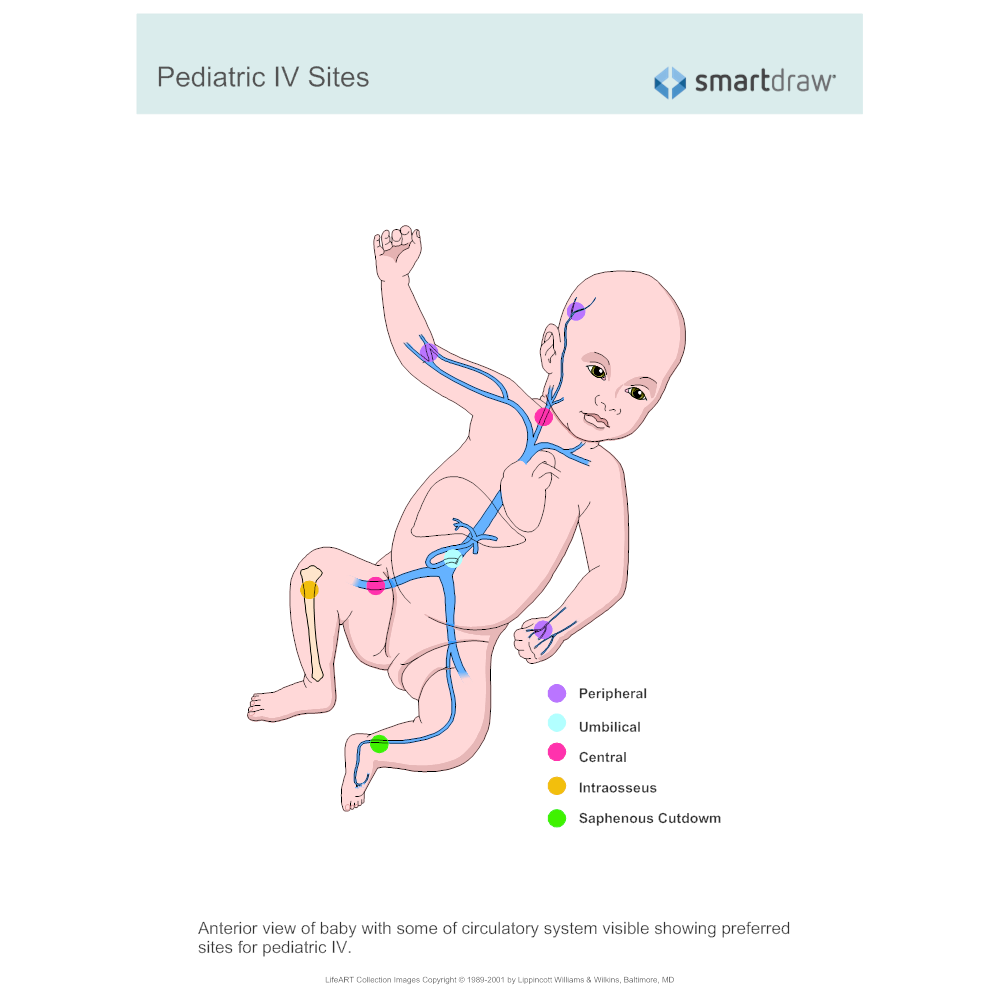 Example Image: Pediatric IV Sites