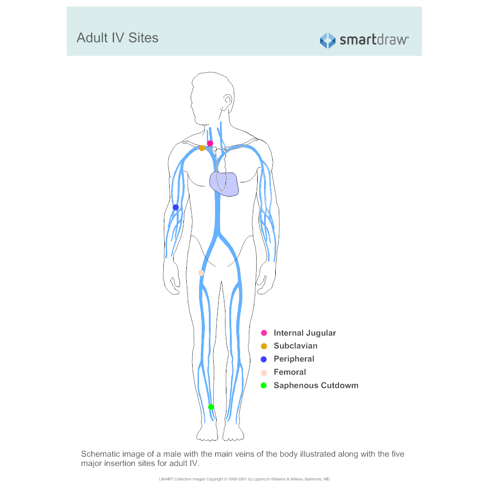 Example Image: Adult IV Sites