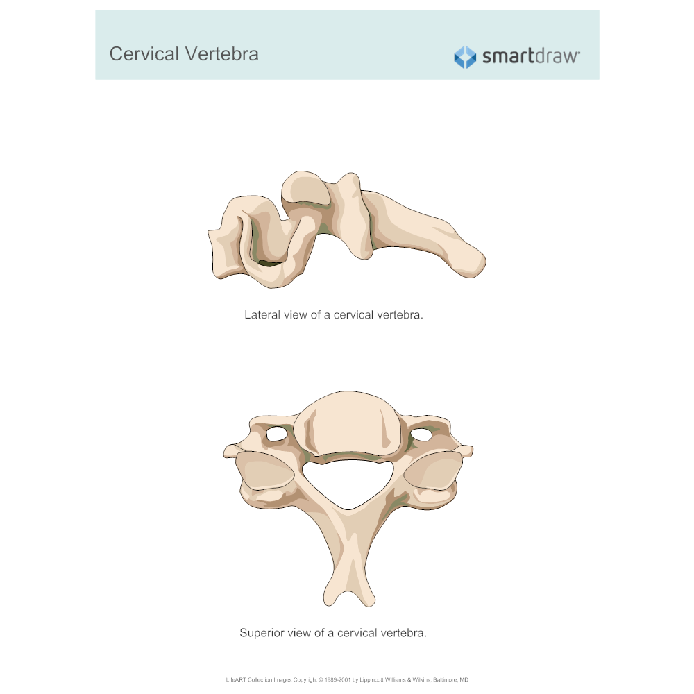 Example Image: Cervical Vertebra