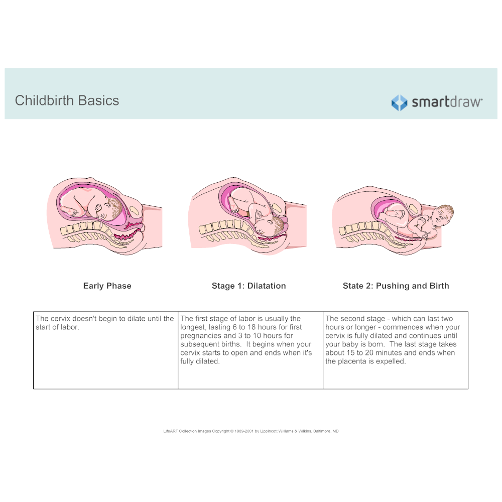 Example Image: Childbirth Basics