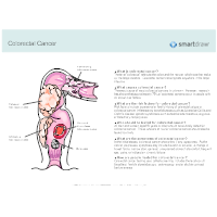 Colorectal Cancer - 2