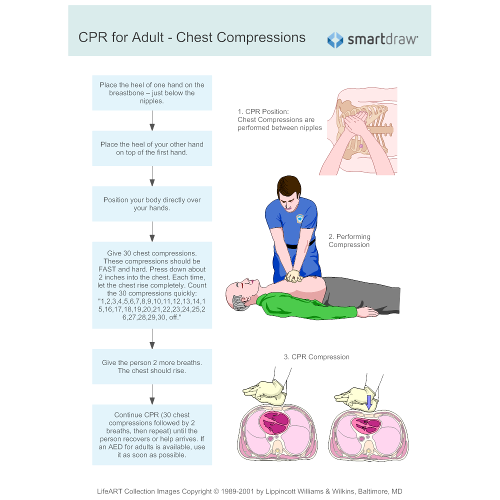 Example Image: CPR for Adult 3 - Chest Compressions