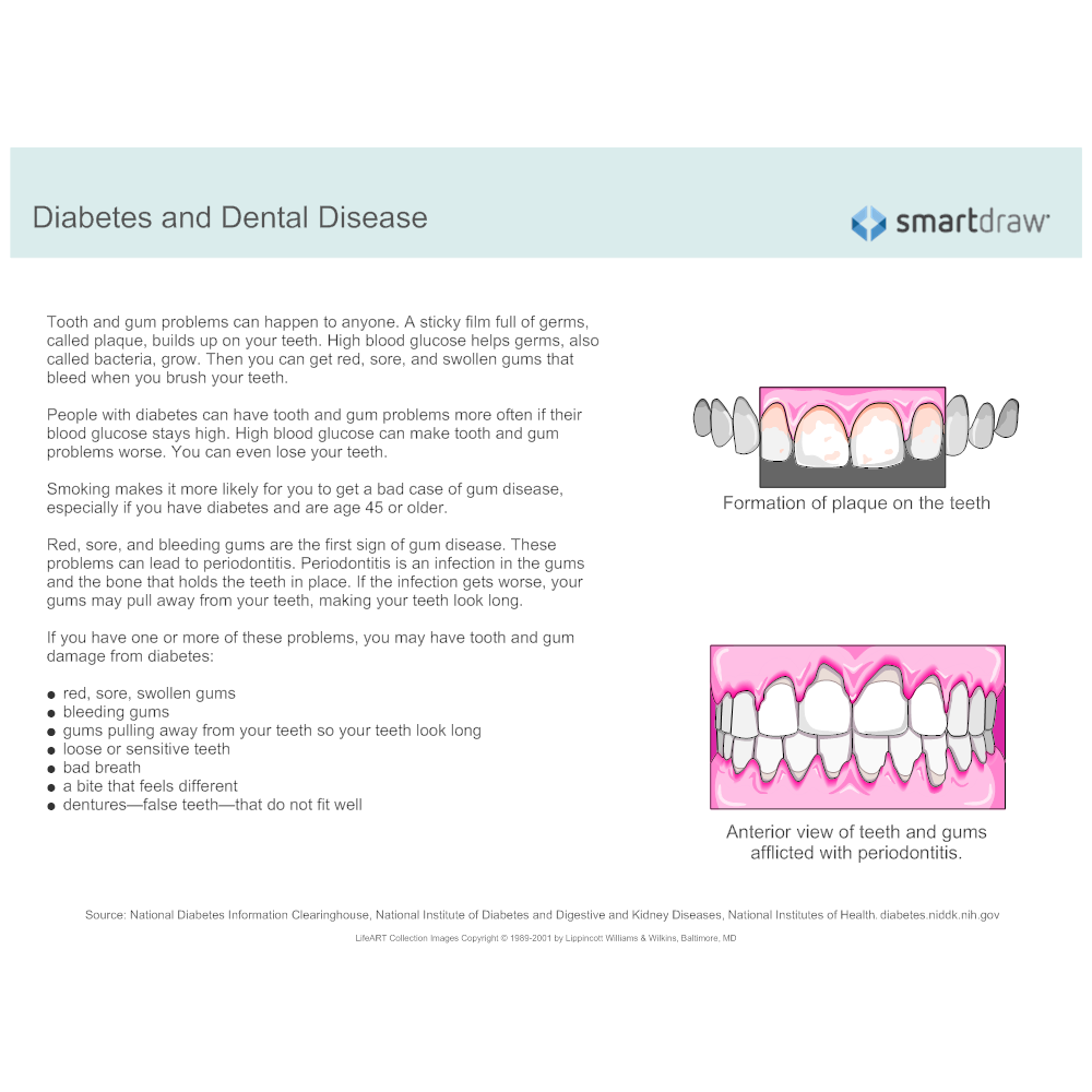 Example Image: Diabetes and Dental Disease