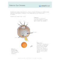 Diabetic Eye Diseases