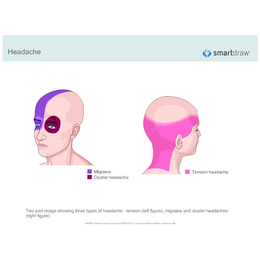Example Image: Headaches
