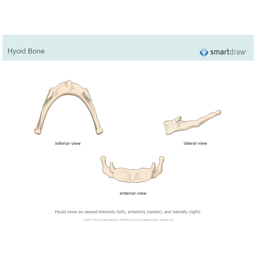 Example Image: Hyoid Bone