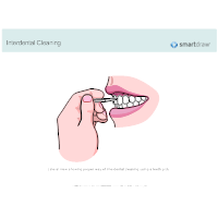 Interdental Cleaning