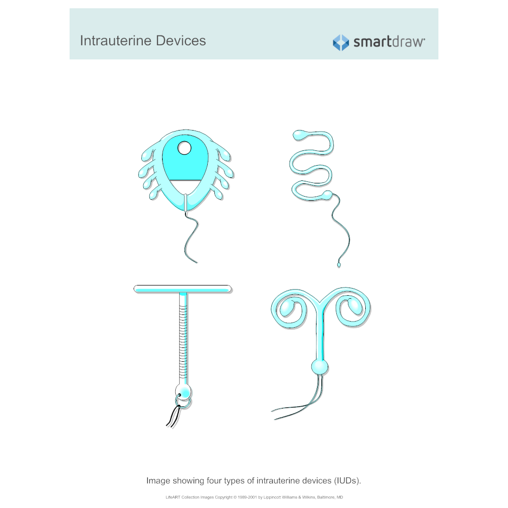 Example Image: Intrauterine Devices