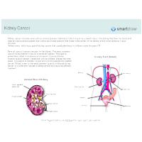 Kidney Cancer