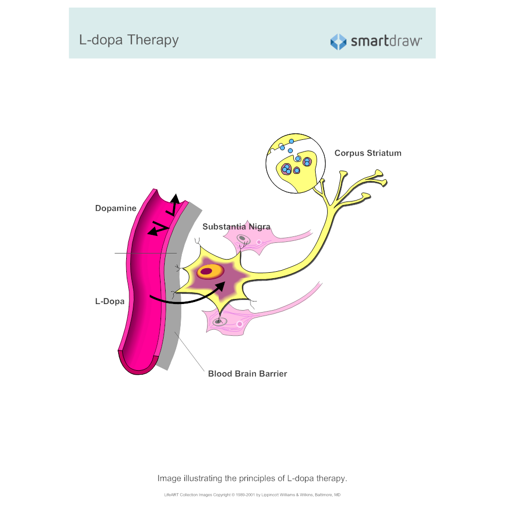 Example Image: L-dopa Therapy