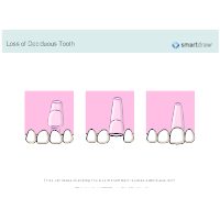 Loss of Deciduous Tooth