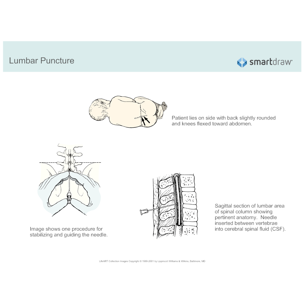 Example Image: Lumbar Puncture