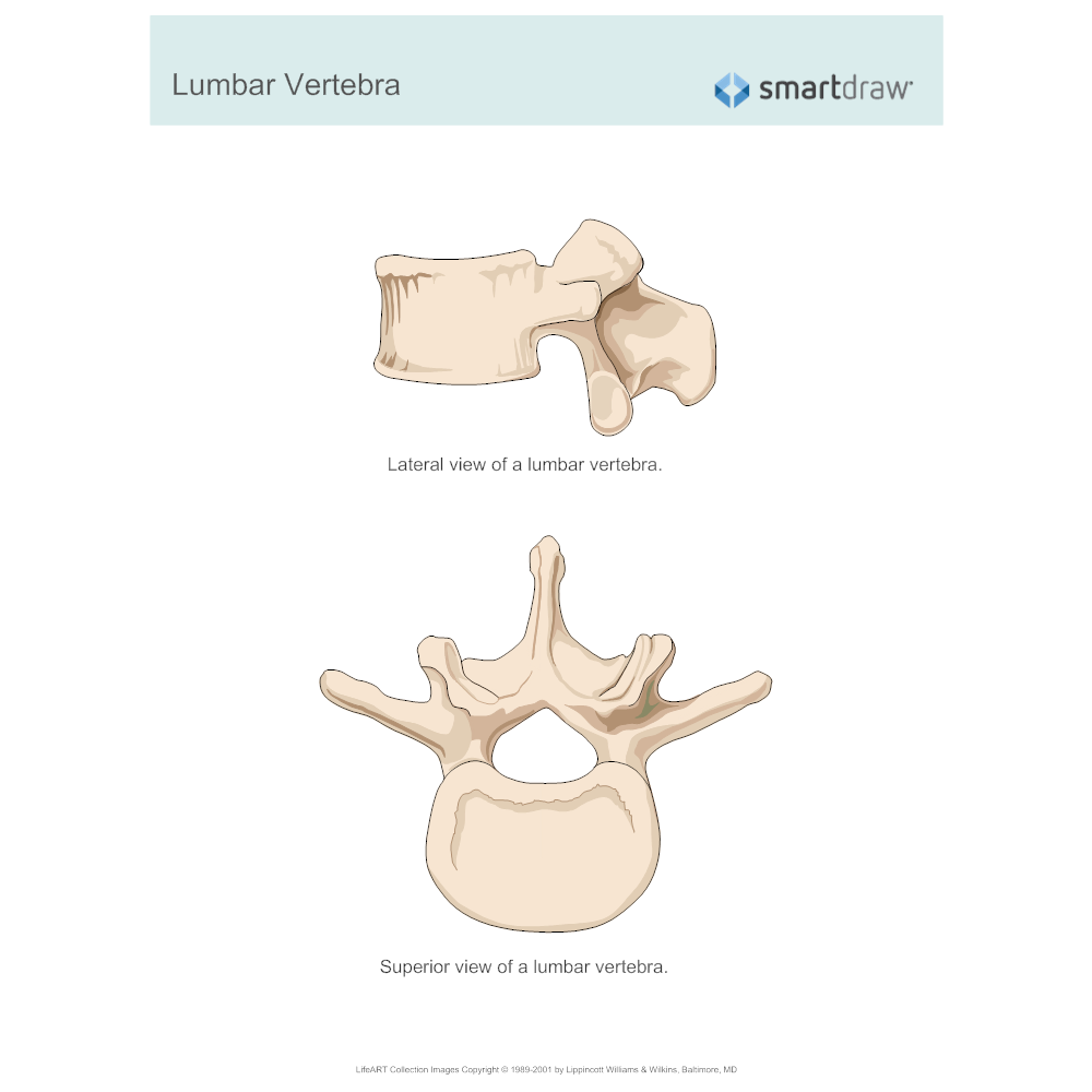 Example Image: Lumbar Vertebra