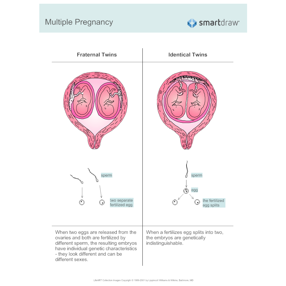 Example Image: Multiple Pregnancy