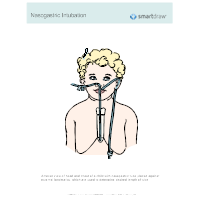 Nasogastric Intubation - 1