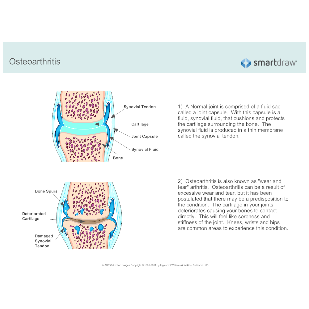Example Image: Osteoarthritis Facts