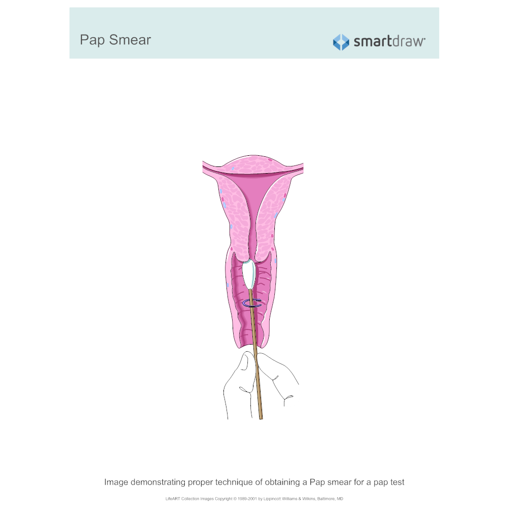 Example Image: Pap Smear 1
