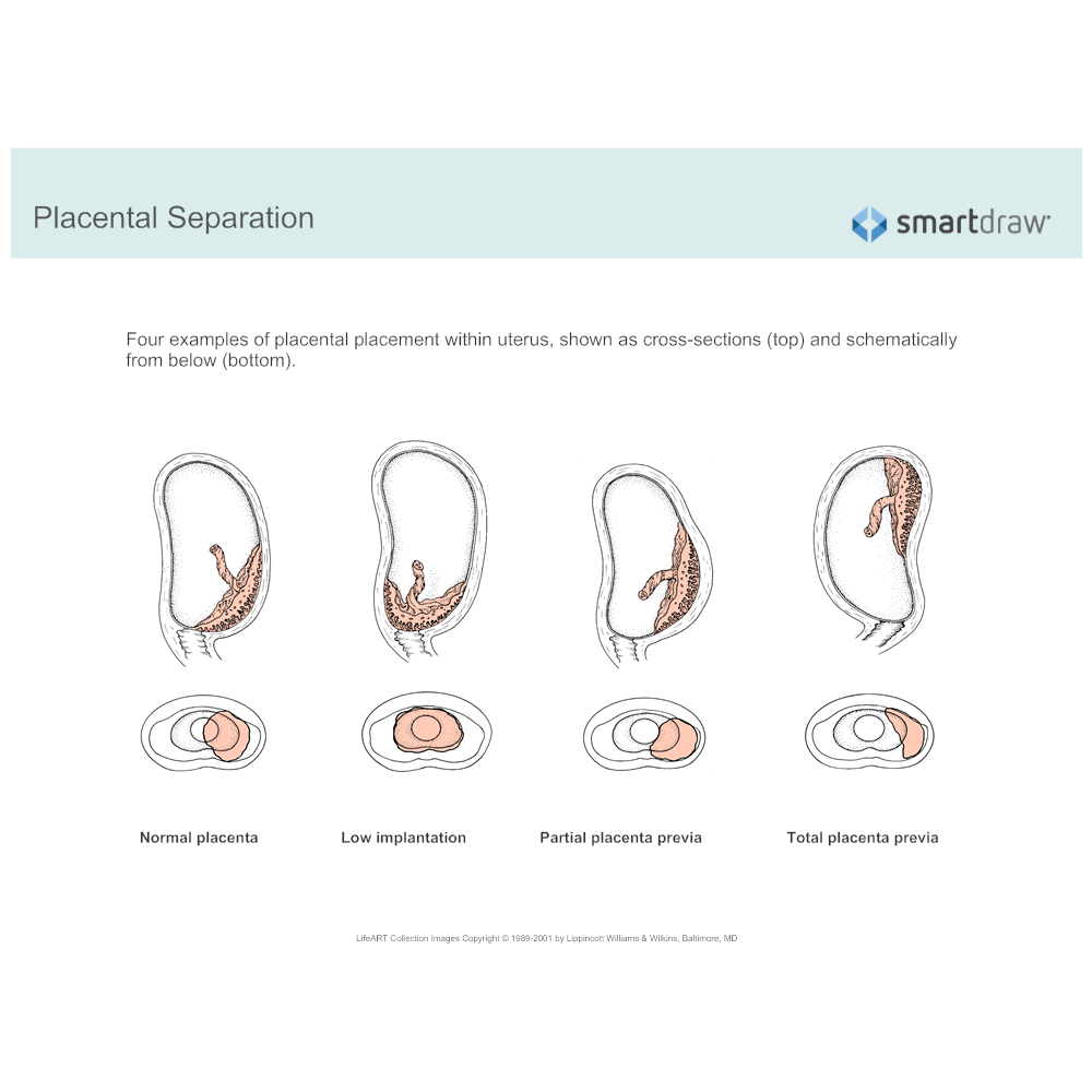Example Image: Placental Separation