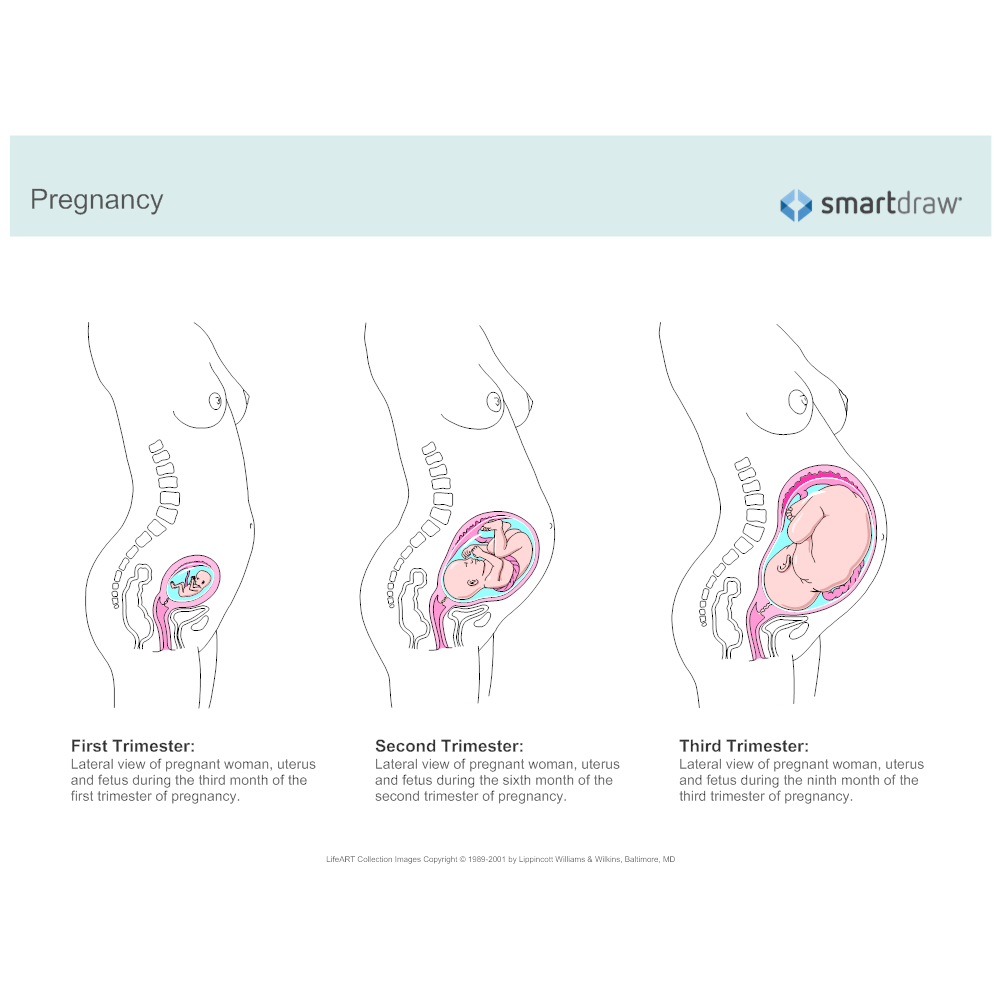 Example Image: Pregnancy