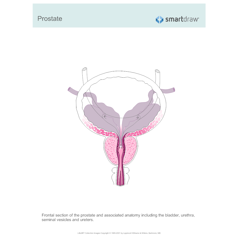 Example Image: Prostate