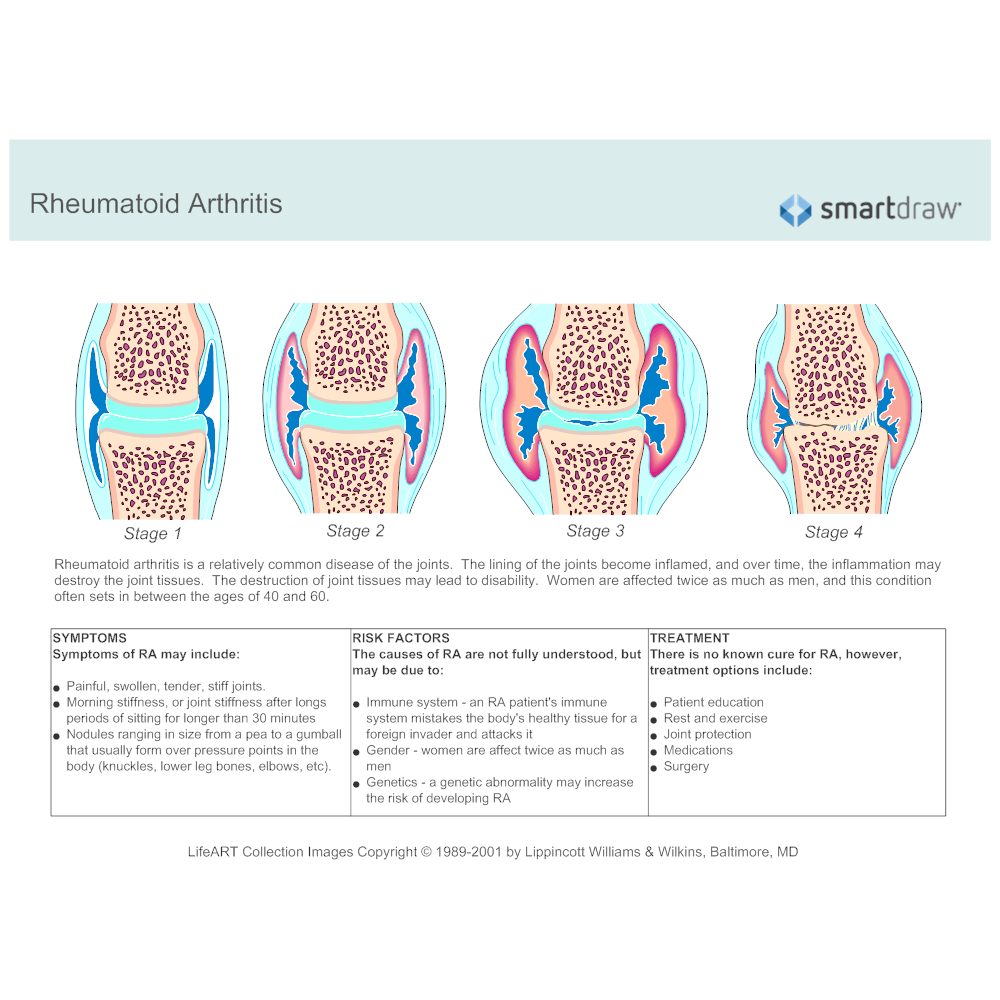 Example Image: Rheumatoid Arthritis