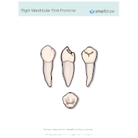Right Mandibular First Premolar