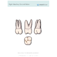 Right Maxillary Second Molar