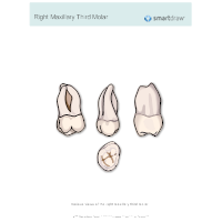 Right Maxillary Third Molar