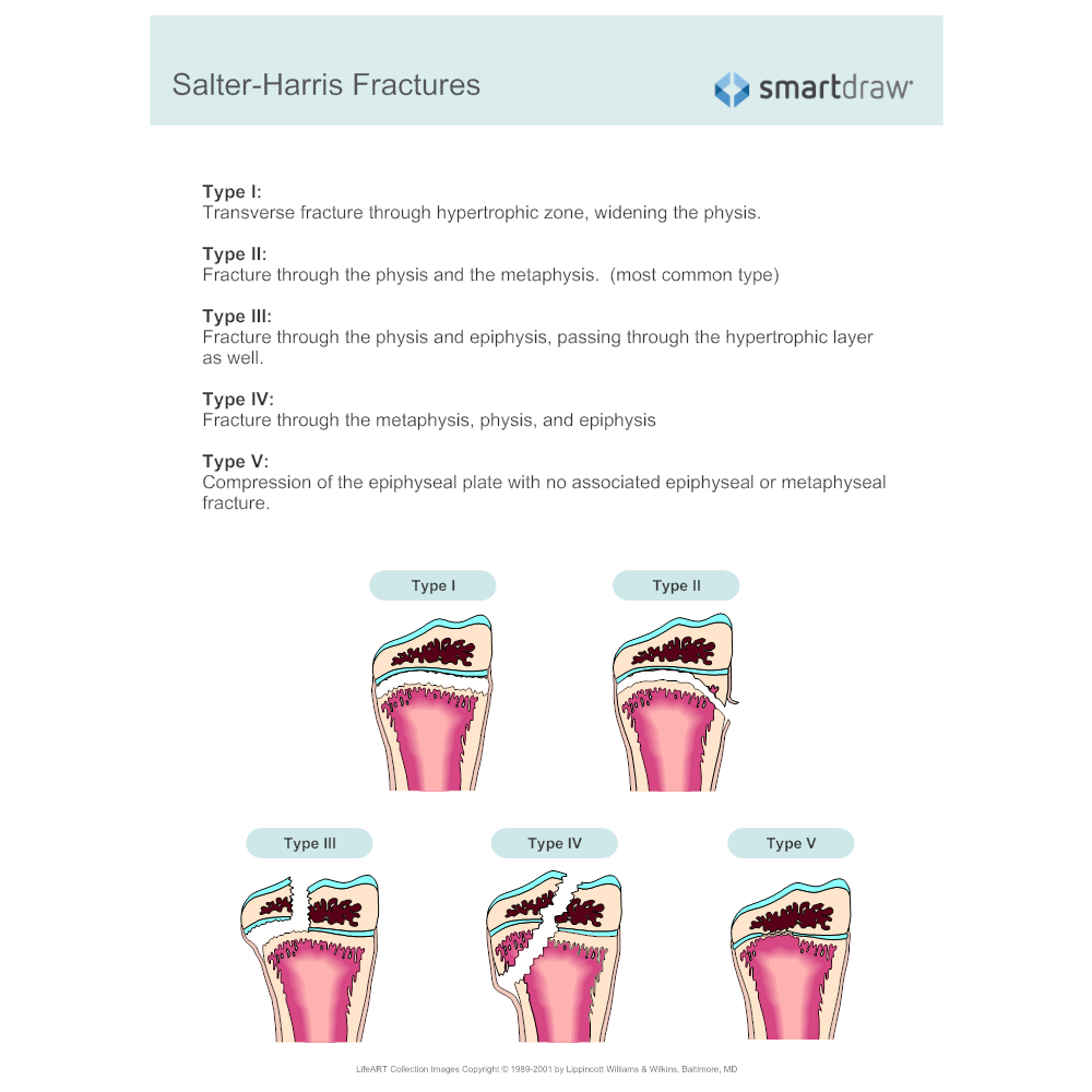 Example Image: Salter Fracture Classification