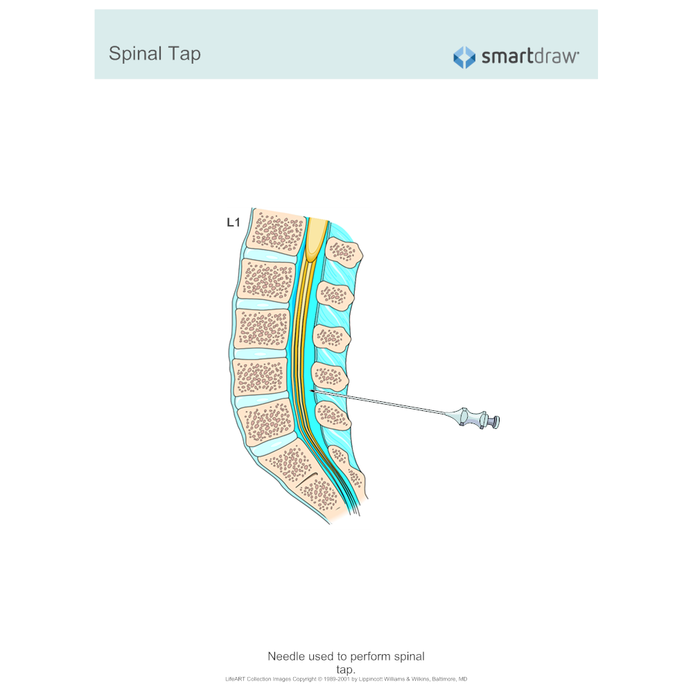 Example Image: Spinal Tap
