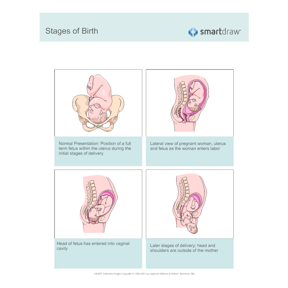 Example Image: Stages of Birth