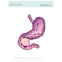 Stomach Ulcers - 3