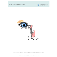 Tear Duct Obstruction