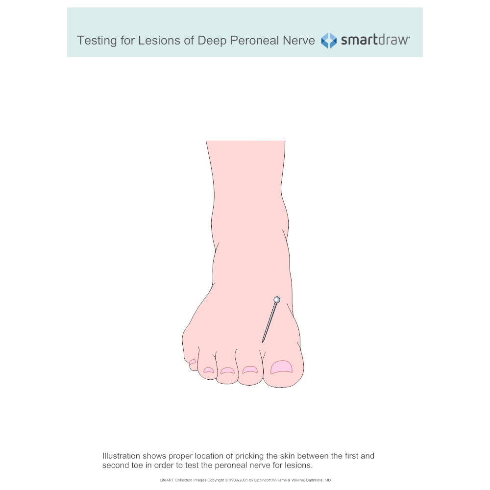 Example Image: Testing for Lesions of Deep Peroneal Nerve