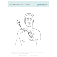 Triple-Lumen Venous Catheter