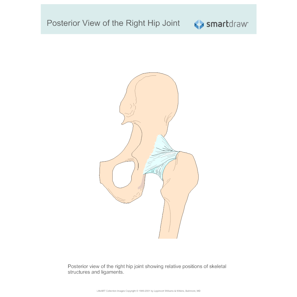 Example Image: View of the Right Hip Joint - Posterior