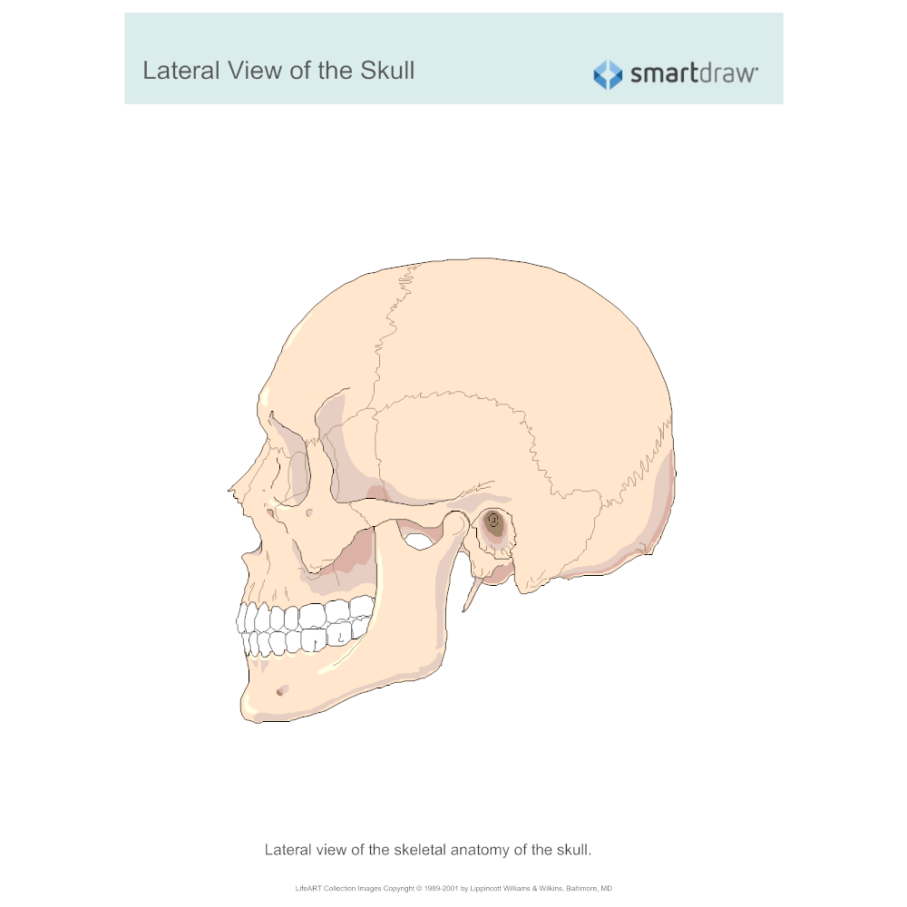 Example Image: View of the Skull - Lateral